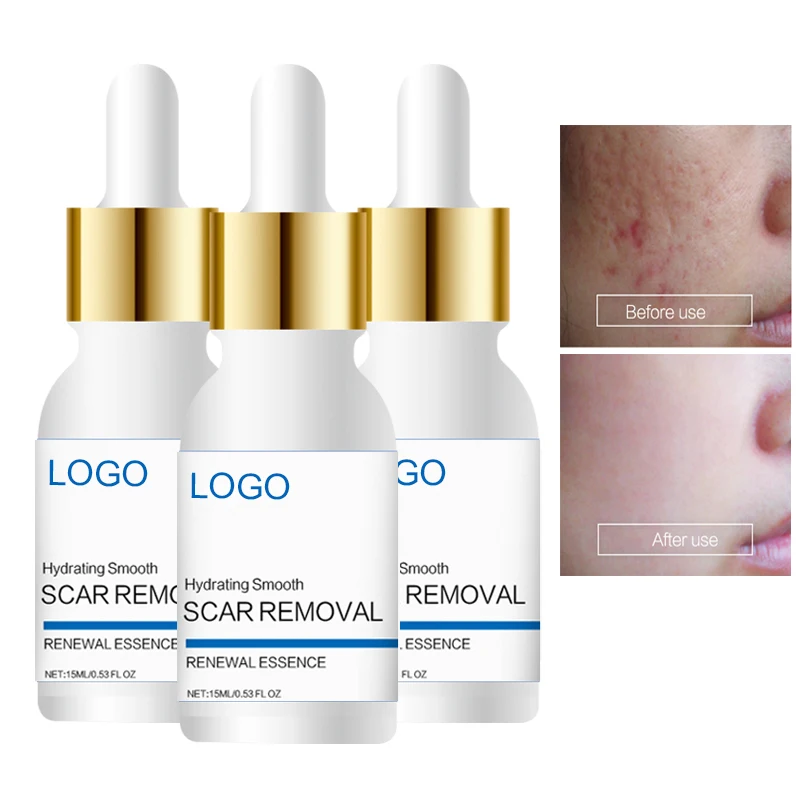 

Private Label Acne Scar Removal Cream Soins Visage Skin Care Moisturizing Essence Freckle Dark Spot Remover Liquid Facial Serum