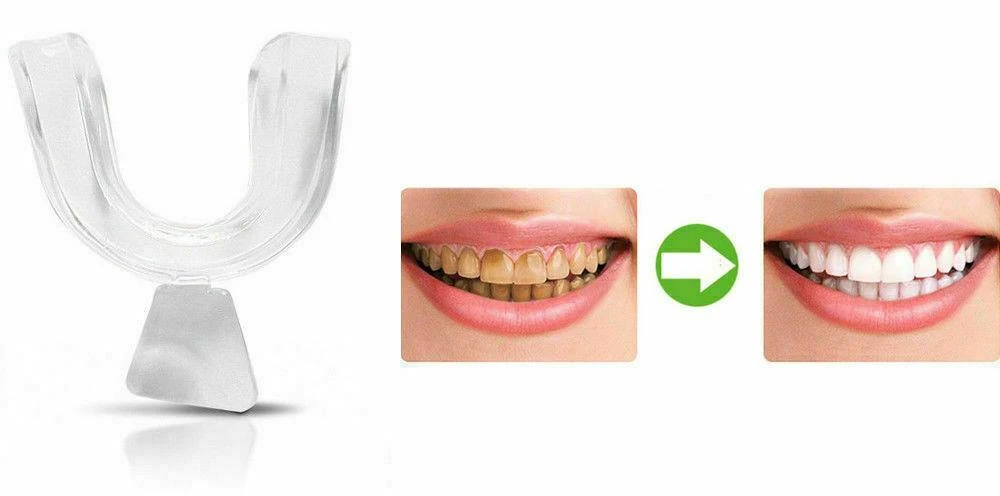 Custom Mouldable Gum Shield Mouth Guard - Buy Custom Mouth ...