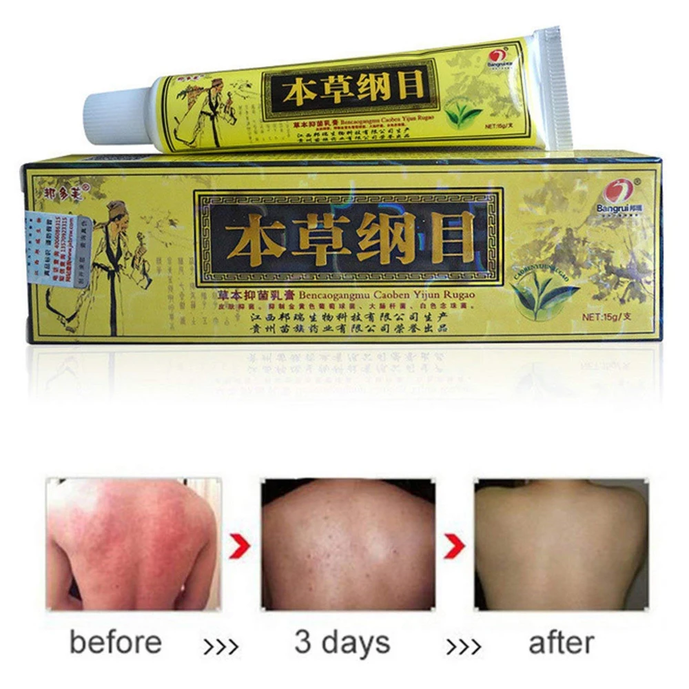 
Chinese Bencaogangmu Herbal Dermatitis Pruritus Psoriasis Cream Ointment 
