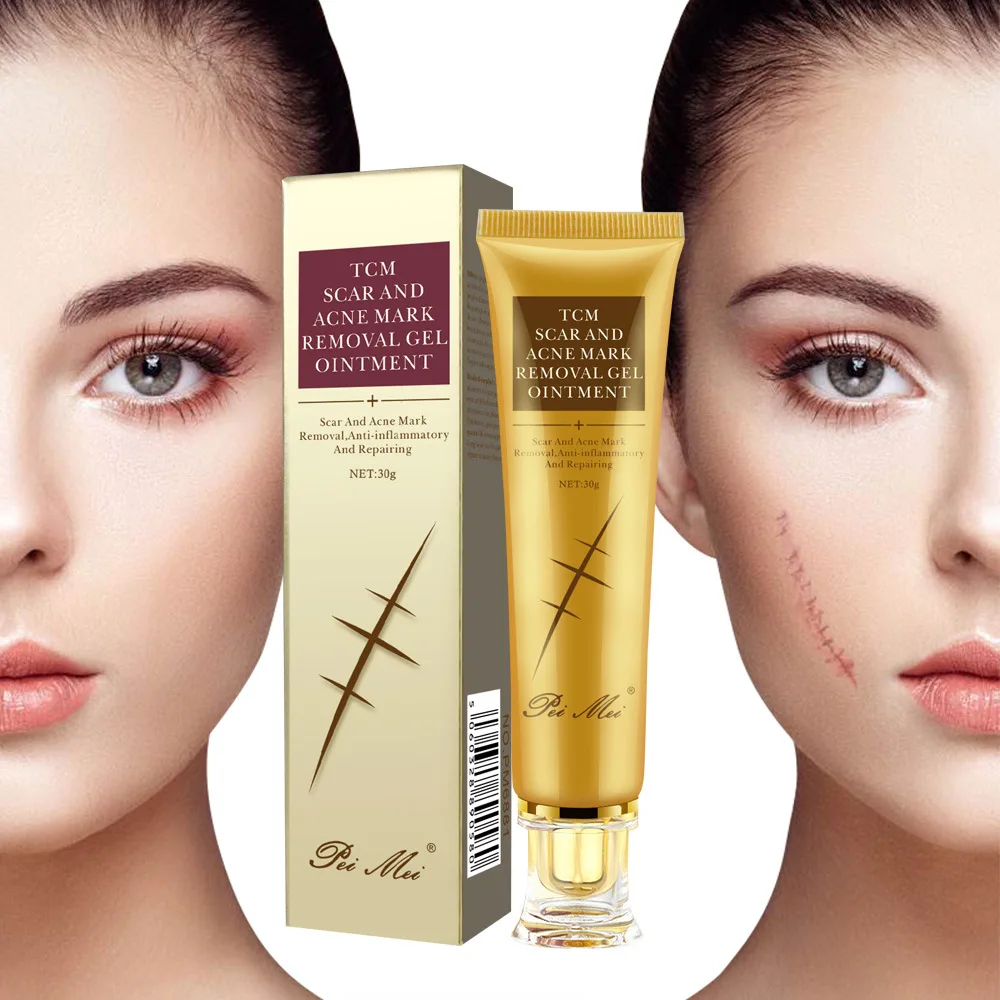 

Face Cream Acne Treatment Scar Removal cream For Face Skin Care Whitening Cream Fades Repair Scars Nourishing For Face