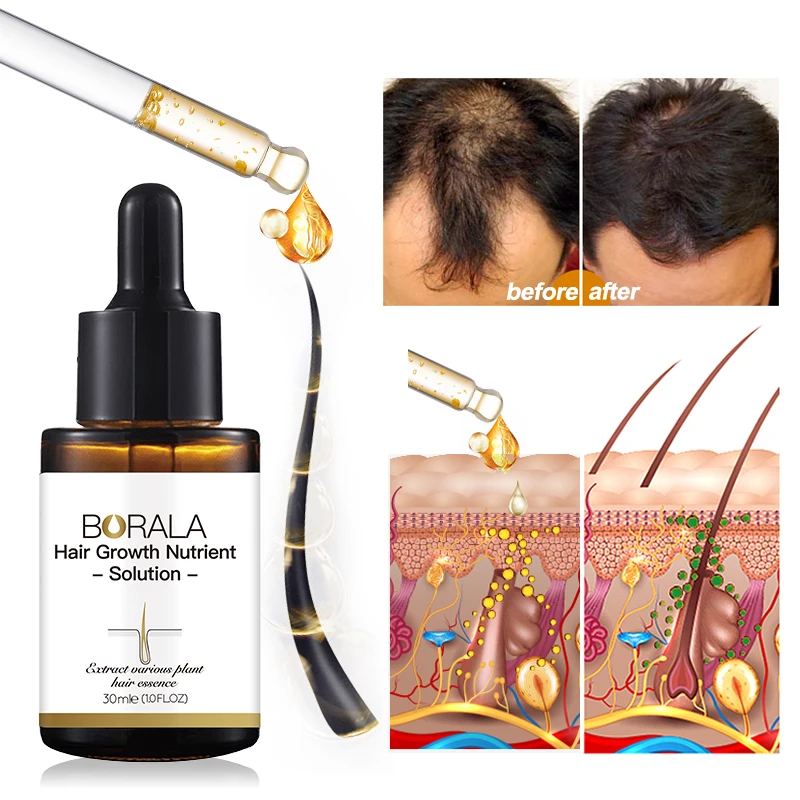 

OEM ODM Hair Growth Nutrient Solution High Quality Private Label Natural Hair Growth Serum Oil Drops Growth Promoter treatment