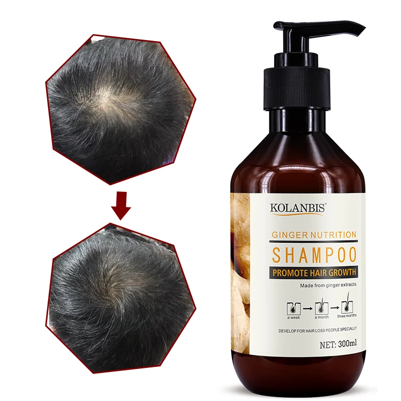 
Herbal Natural Ginger Hair Growth Shampoo for Hair Anti Hair Loose Private Label Product Line  (62412579148)