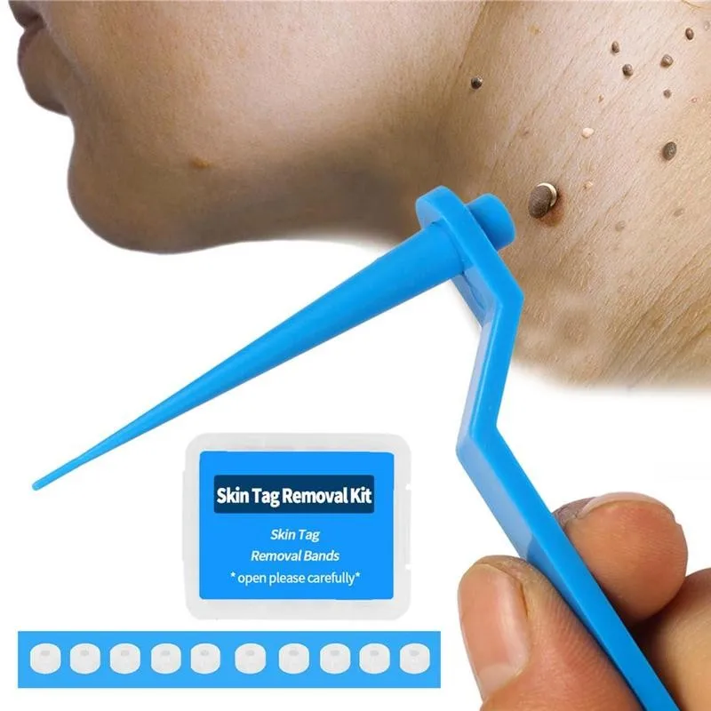 

1set Skin Tag Kill Skin Mole Wart Remover Micro Band Skin Tag Removal Kit With Cleansing Swabs Adult Mole Wart Face Care, Blue