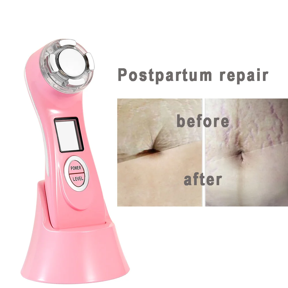 

new stretch mark removal machine use stretch marks oil remover stretch makrs in home use, White, black, pink