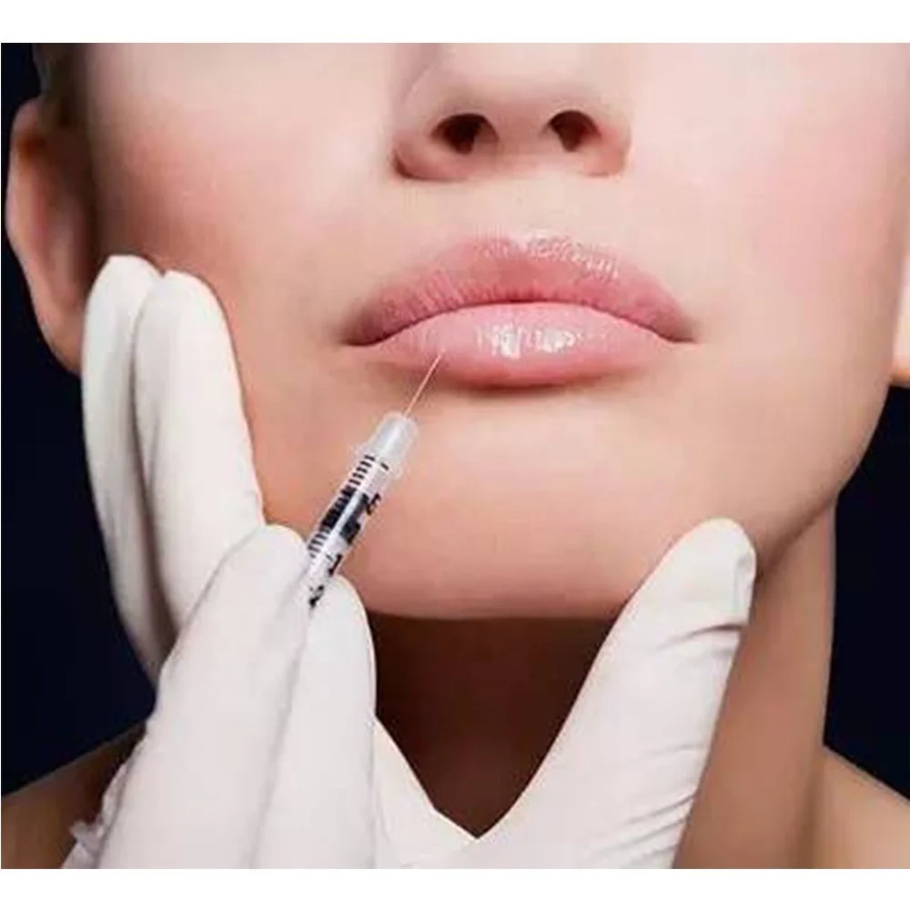 

MIYADERM acide hyaluronique seringue cheeks enhancer injection