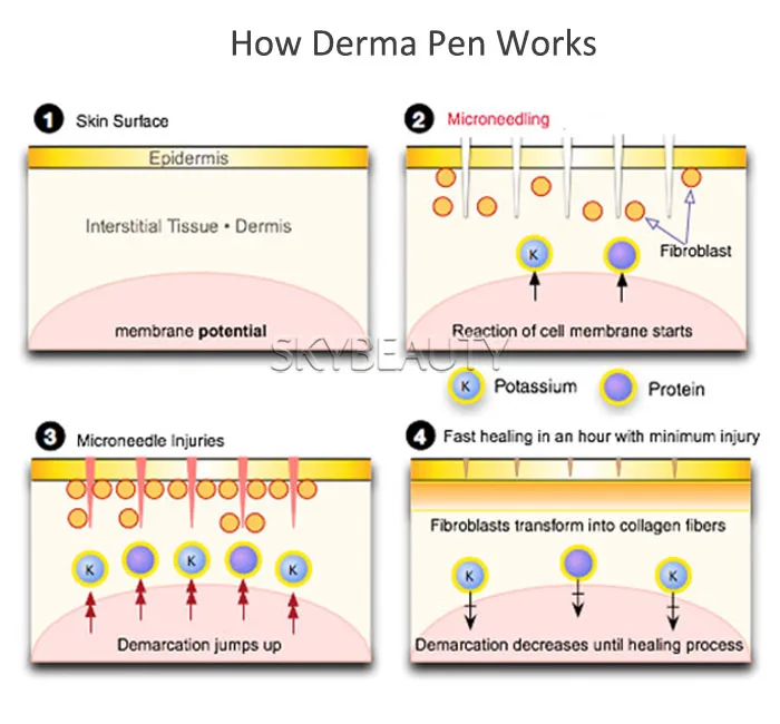 How Derma Pen Works