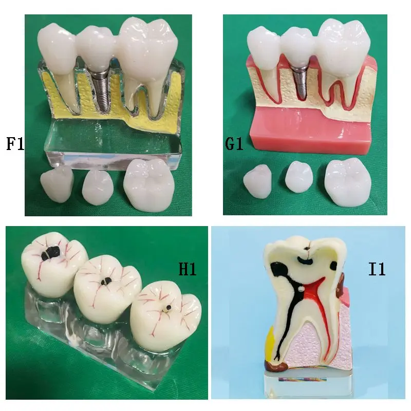 Dental Teaching Practice Tooth Model Type B Buy Dental Replaced Teeth