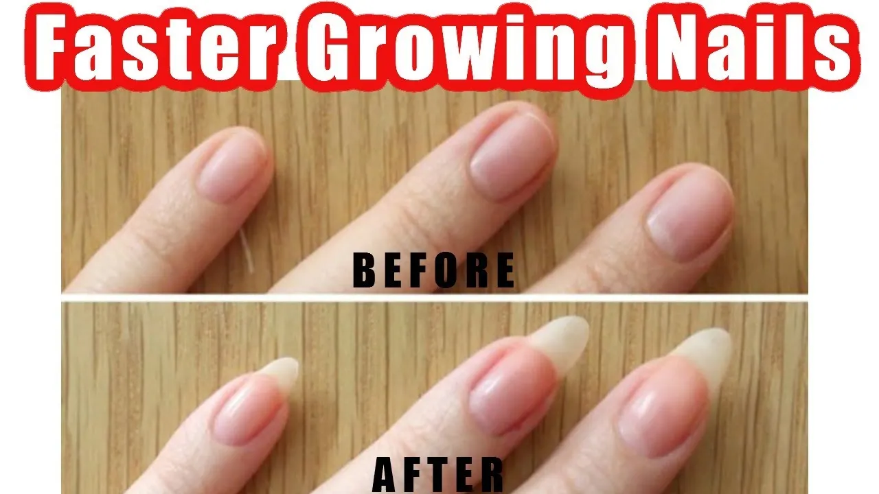 Как отрастить ноготь с нуля. The grow ногти. How to make Nail grow faster.