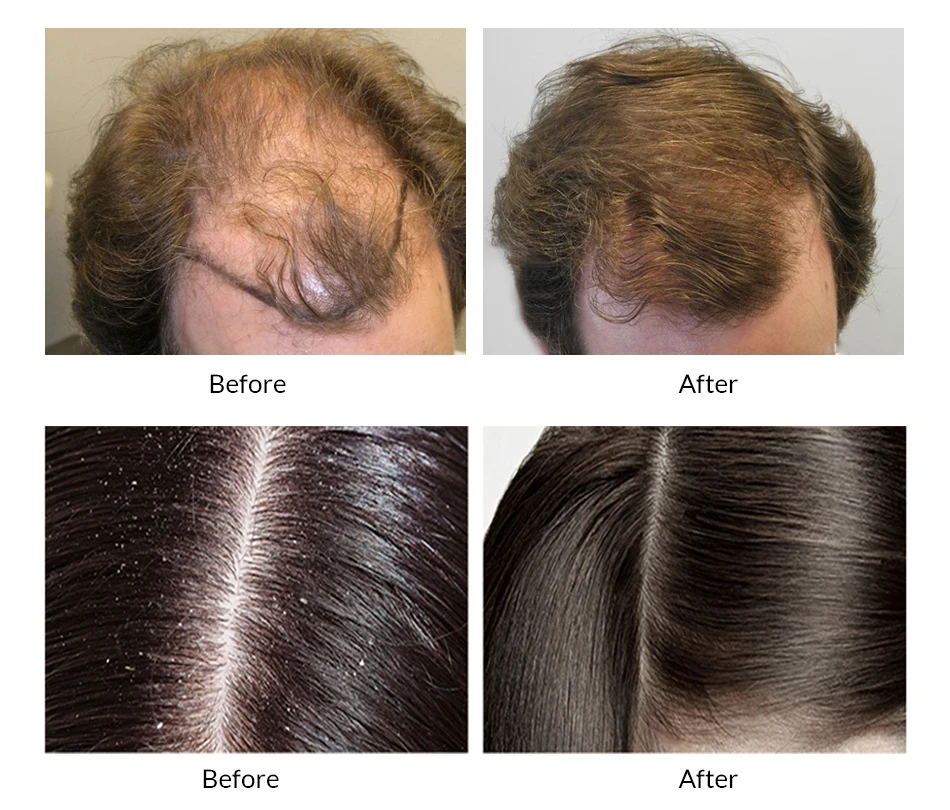 韩国品牌 omy 女士 dermacare 头皮头发修复洗发水油