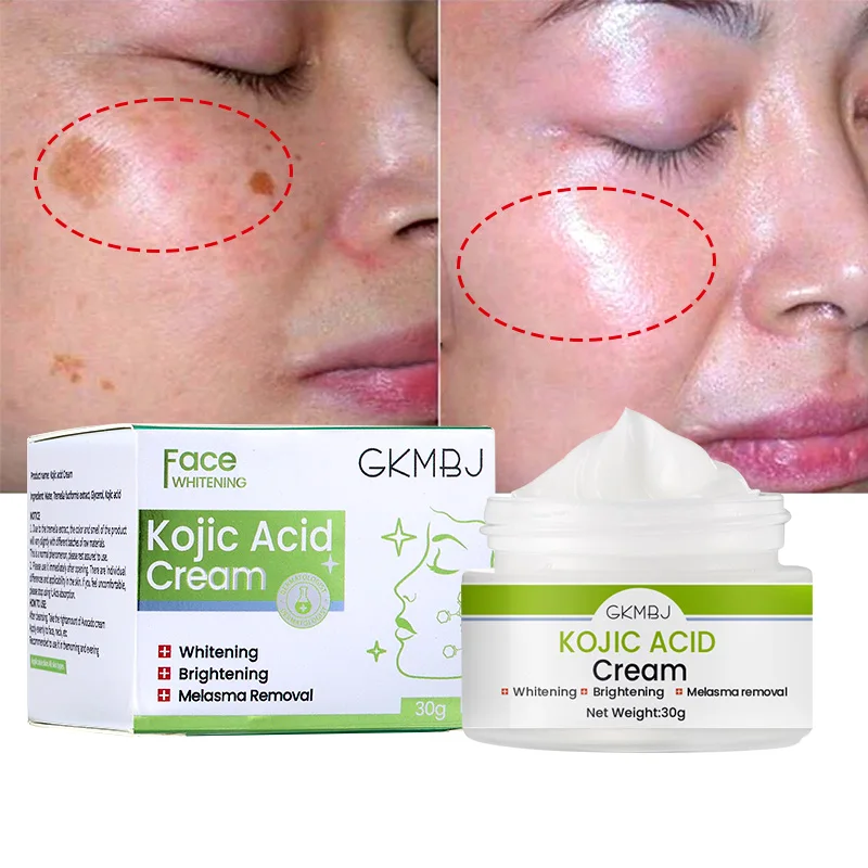 

eco-friendly microbial fermented skin carekojic acid papaya cream skin whiteningdark spot removal kojic night face cream