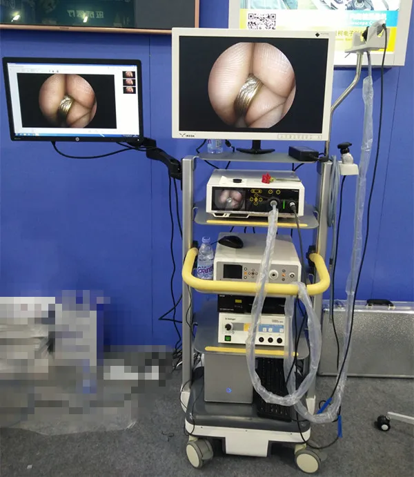 YKD-9001 HD Camera set (2)