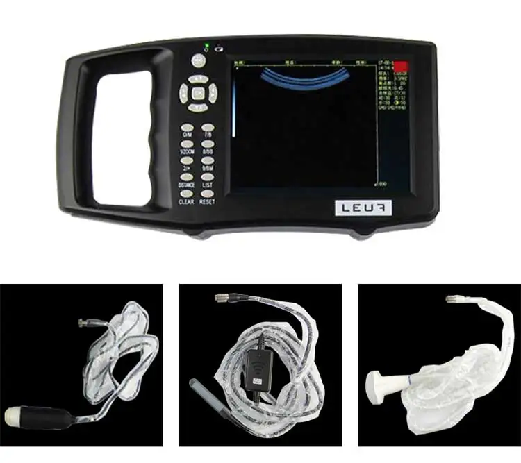 ultrasound scanner