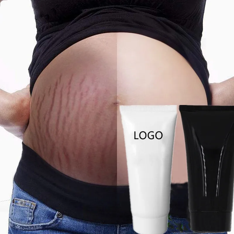 

2021 wholesale vitamin e cream skin care scar removal cream 100g