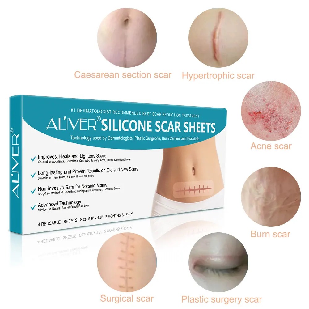 

ALIVER face belly leg scars removal effective treatment surgical scars skin repair body scar removal silicone sheet