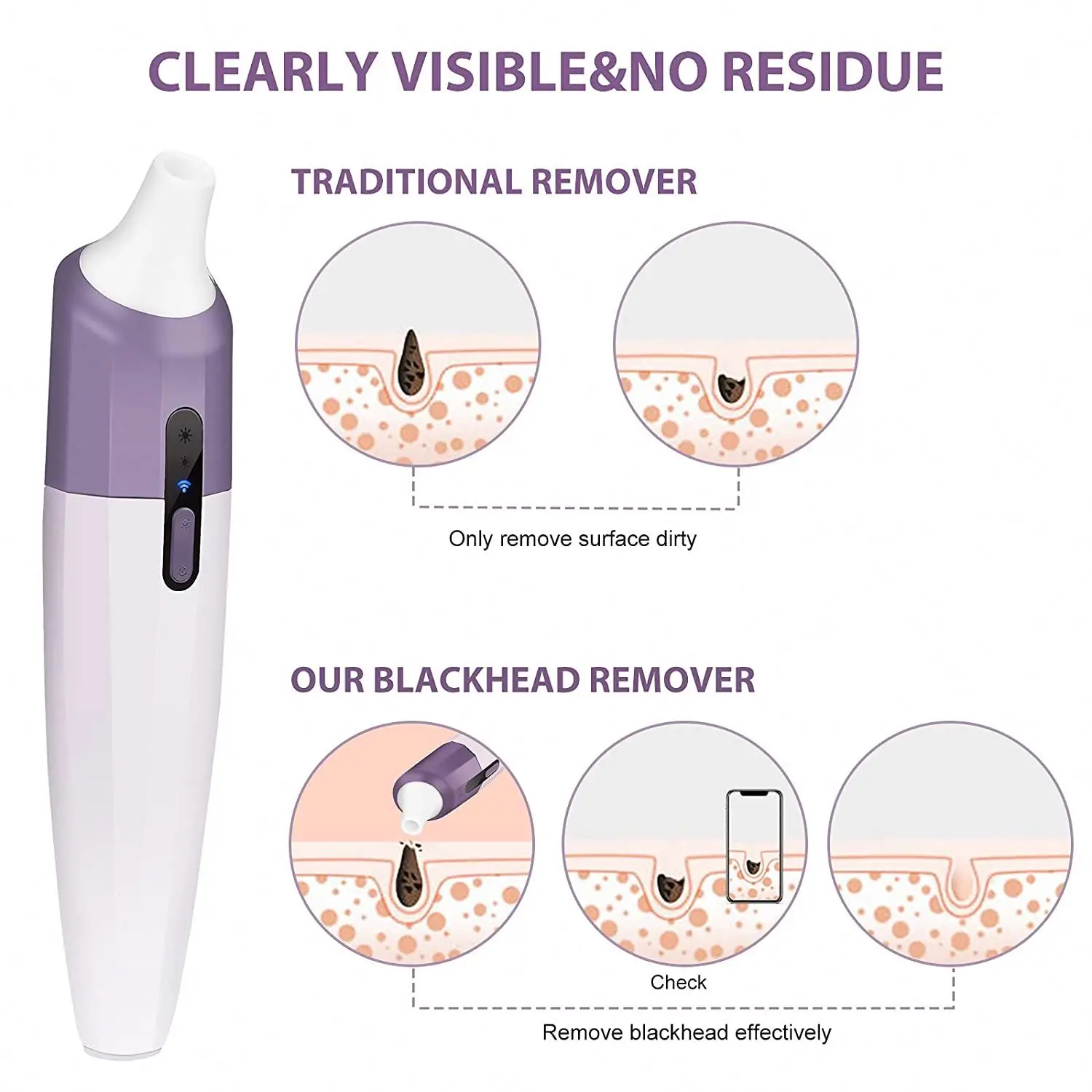 

Lead The Industry Factory Price Skin Care Products Blackhead Remover, White