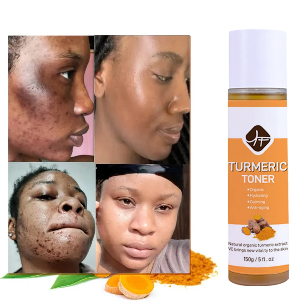 

Natural Organic Turmeric Whitening Vitamin C Refershing Moisturizing Mint Facial Skin Care Skincare Moisturizing Face Skin Toner