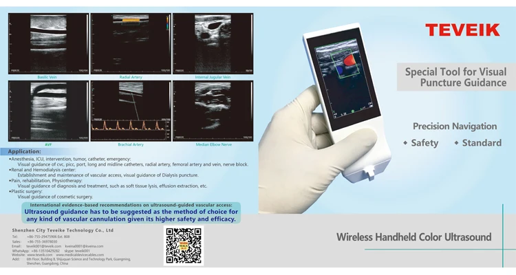 A ponta de prova handheld sem fio a menor do ultrassom da cor com toque e exposição screen.jpg