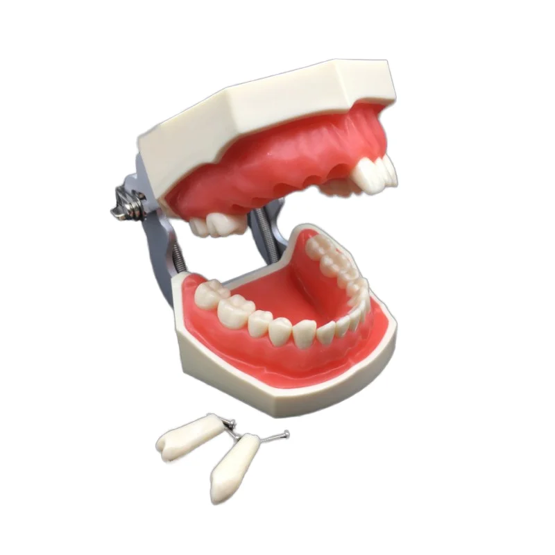 Dental Implant Model Teeth Model with Pathologies Removable Dental Model