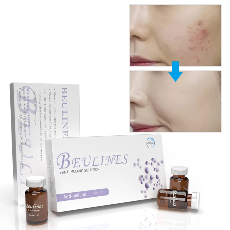 

Hyperpigmentation Hydroquinone Vitamin C Serum Dark Spot Hyperpigment Remove Meso Solution Spot Removal