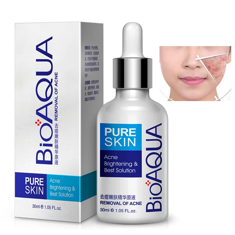 

BIOAQUA acne treatment brightening best solution 30ml skin nourishing hydrating moisturizing grease balancing face serum acne