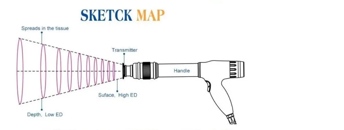 shock ed 1000 shock wave machine for ed / for erectile dysfunction