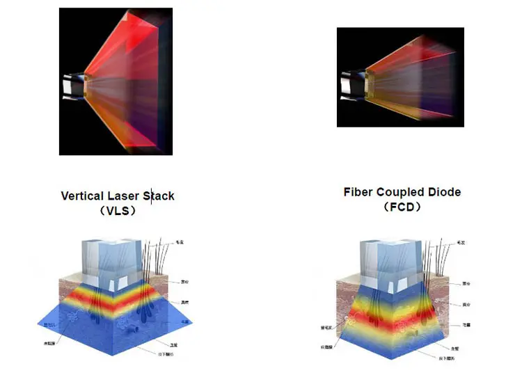 02 808 fiber laser hair.jpg