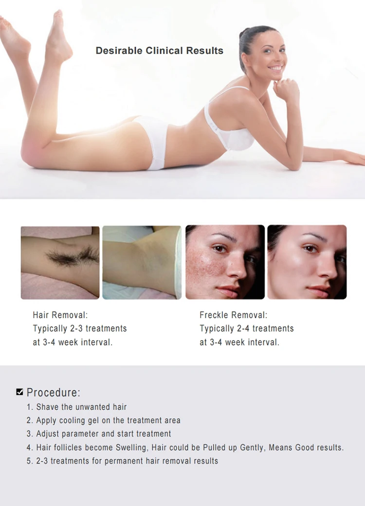 best selling products elight ipl rf beauty equipment / e-light ipl rf+nd yag laser multifunction machine ipl china