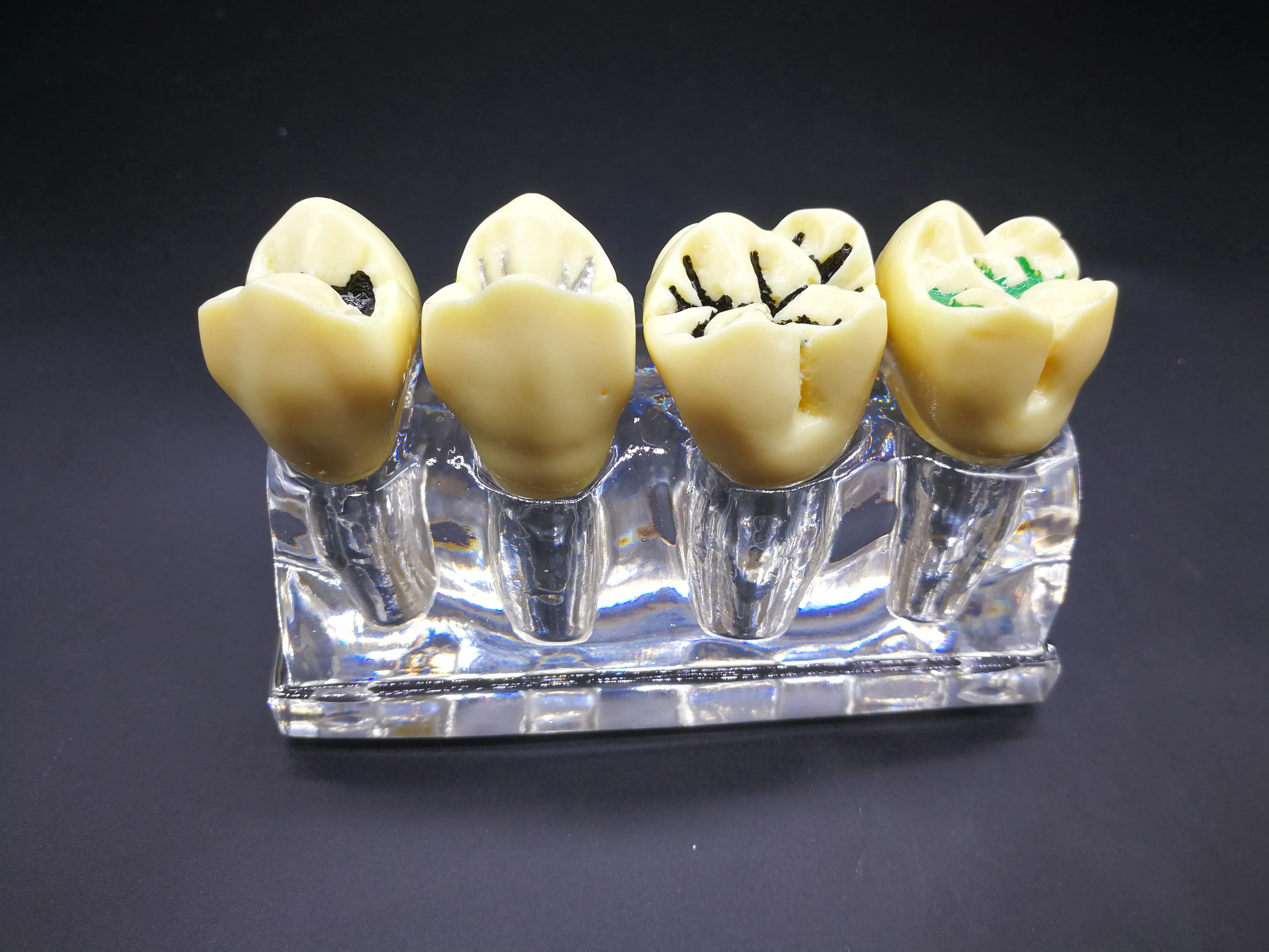 dentalimplant图片