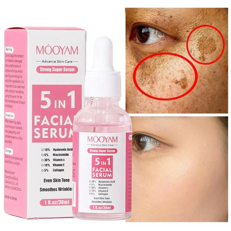 

5 in 1 Serum Whitening Fade Dark Spot Freckle Brighten Essence Remove Pigment Melanin Correcting Beauty Face Serum