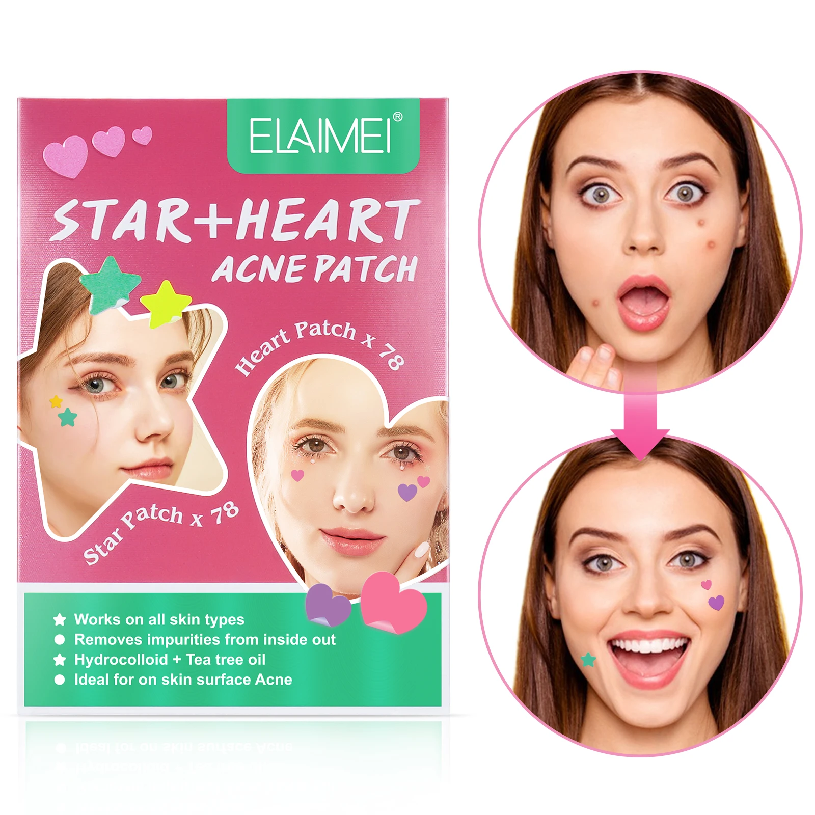 

ELAIMEI Waterproof Hydrocolloid Acne Spot Treatment Plaster Pimple Patches Master Patch Acne Patch