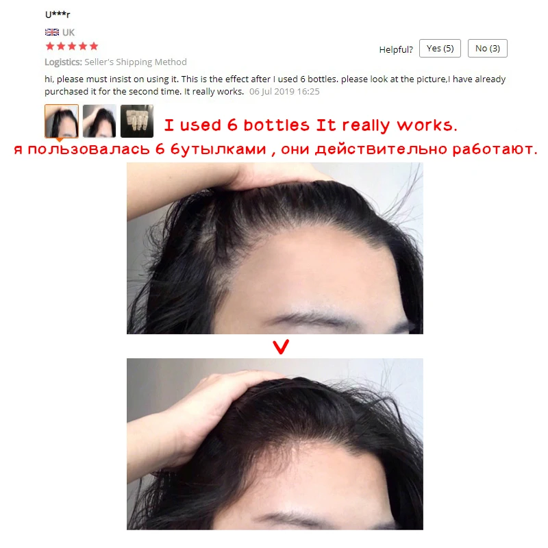 
2 Weeks Restore Hair Growth Oil Men Anti Hair Loss Treatment For Women 