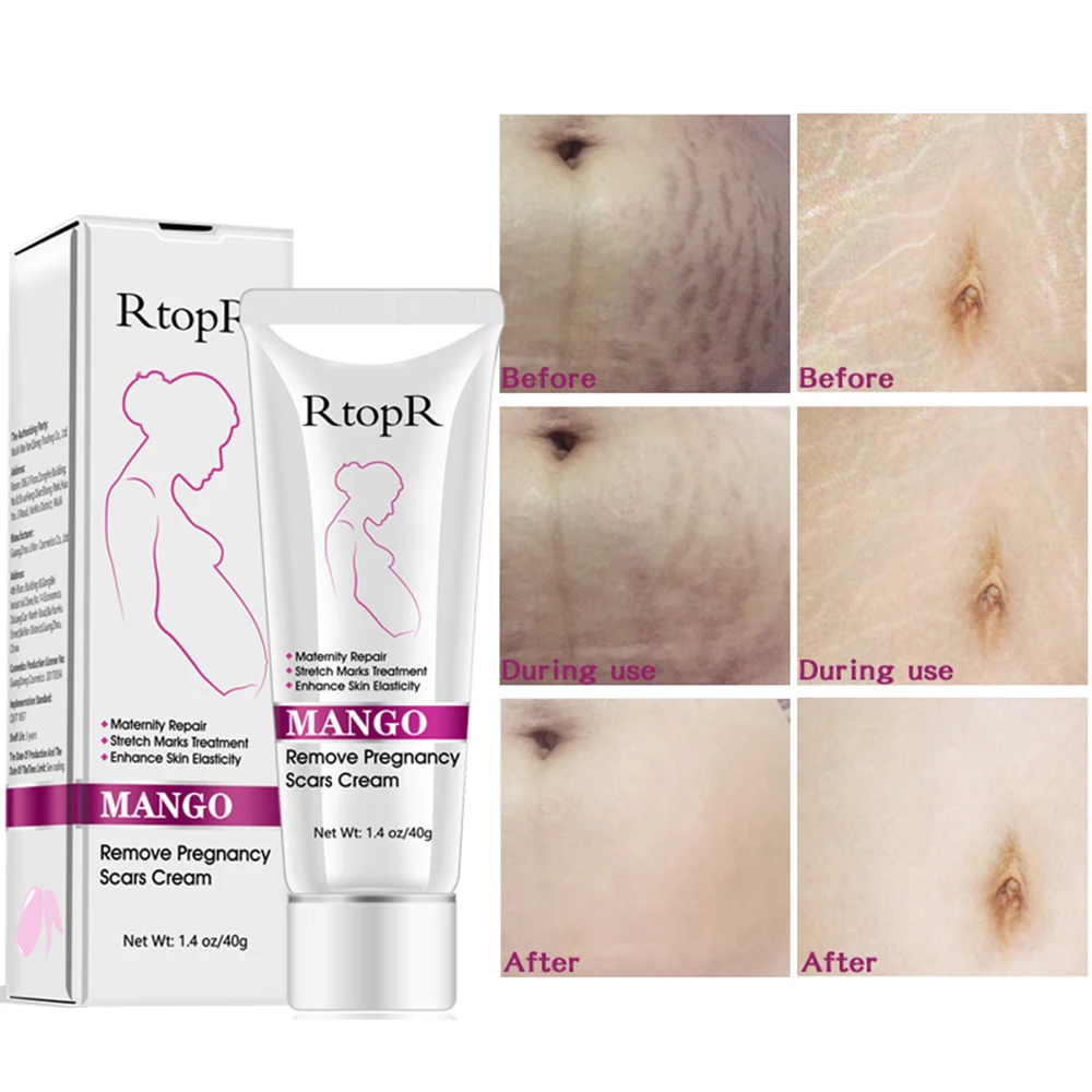 High Quality Scar Removal Cream