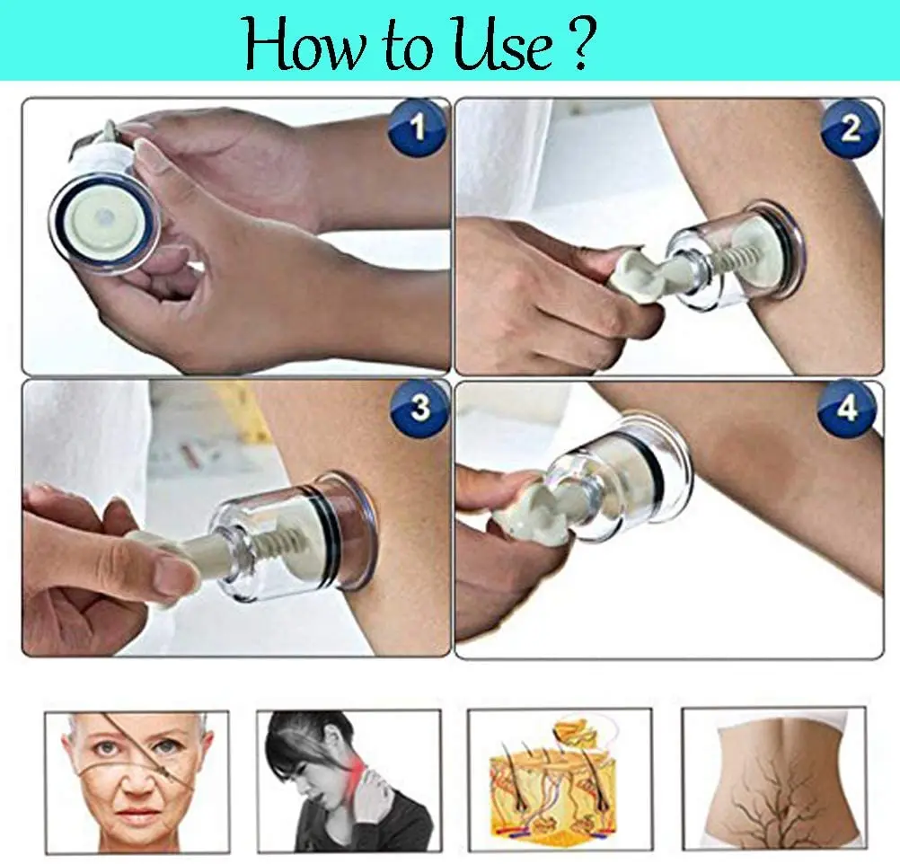 Yifang Brand Twist Top Cupping Set Vacuum Suction Cup Anti Cellulite