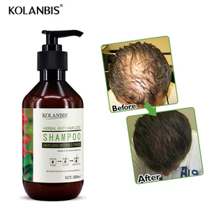 GMP 2 in 1 anti loss hair growth shampoo OEM effective 300ml
