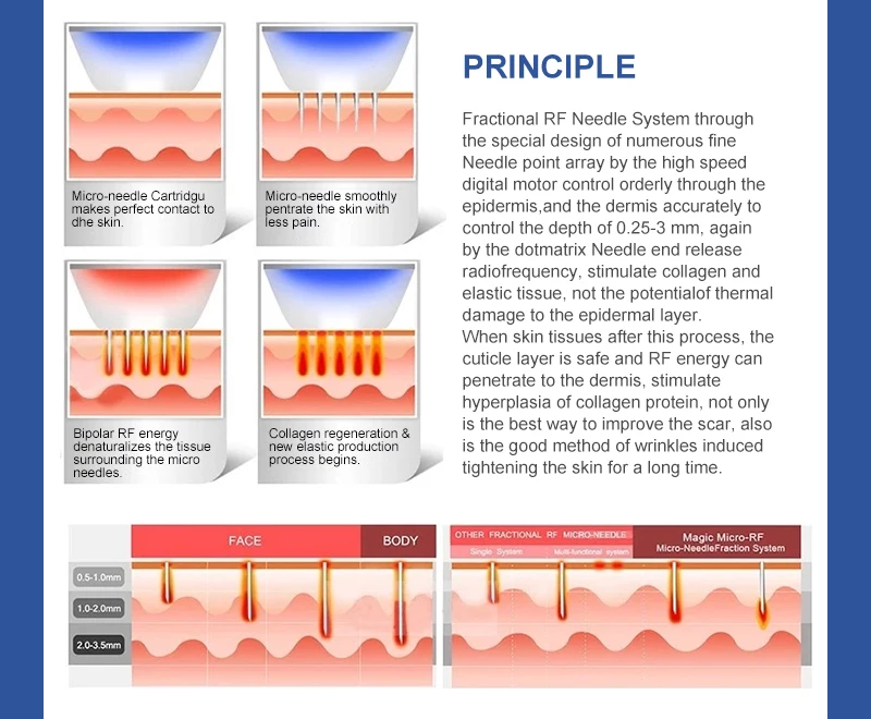 Portable acne remover hair loss fractional rf micro needle microneedle derma pen roller