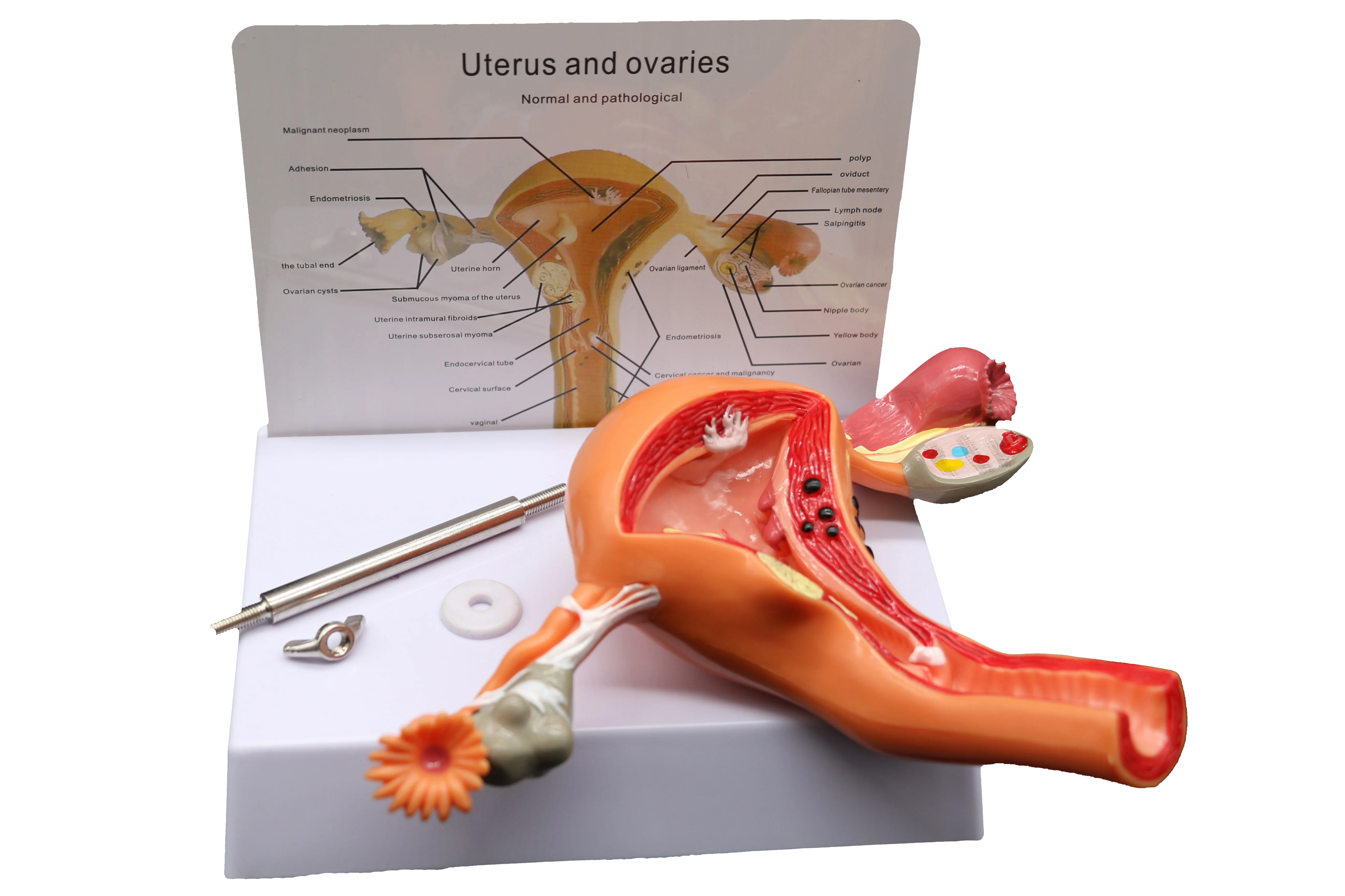 病变的子宫模型图图片