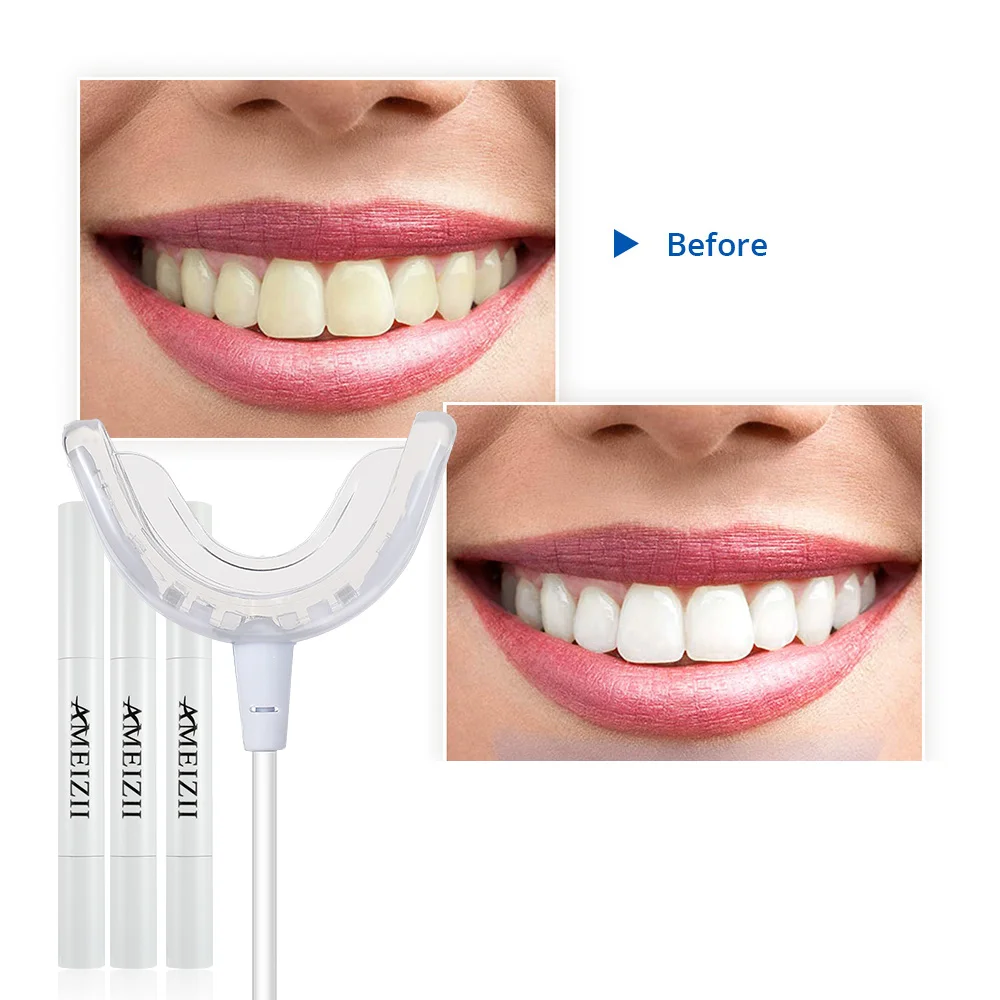 

Portable Teeth Whitening Kits Private Logo 16 Blue LED Lamp Dental Bleaching Machine Blanqueador De Dientes Tooth Whitener Gel