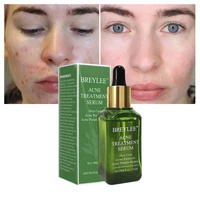 

BREYLEE tea tree extract acne scar removal serum for skin repair free shipping