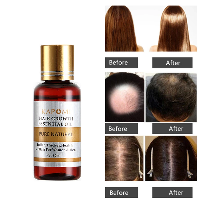 

100% Hair Loss Liquid Health Care Beauty Dense Hair Growth Serum Hair Growth Essential Oil