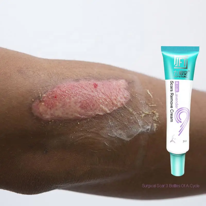 

Scar removal cream stretch marks removal