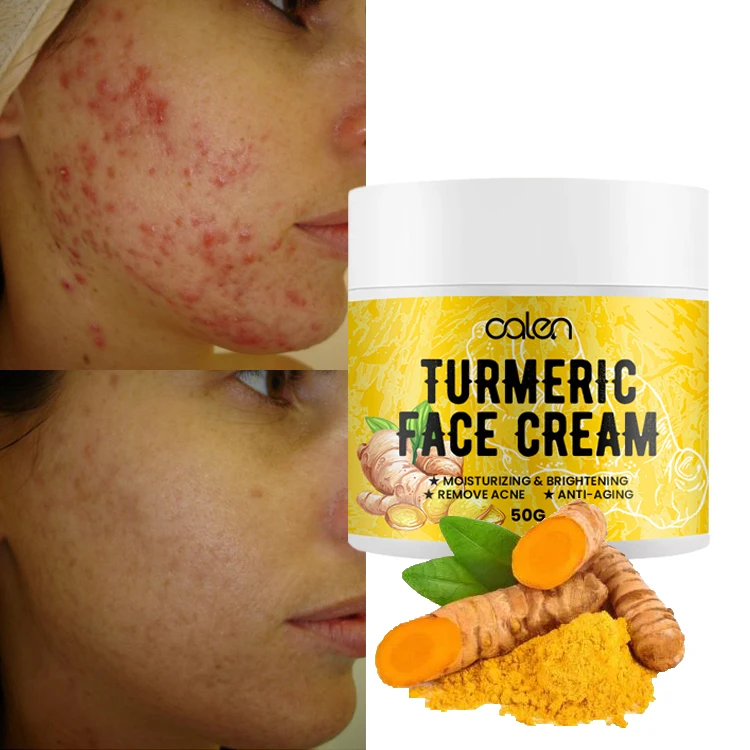 

Oalen Wholesale ODM OEM 100% Natural Acne Treatment Whitening Anti-aging Turmeric Face Cream