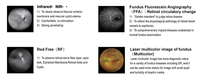 Caméra velcro PLUS, dispositif laser de balayage à Ultra-large zone, anatomie de la retina, focale laser, caméra fundus