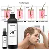 /product-detail/hair-balding-treatments-and-alopecia-cure-help-healthy-hair-growth-and-hair-regrowth-for-family-men-and-women-daily-use-30-days-60682030272.html