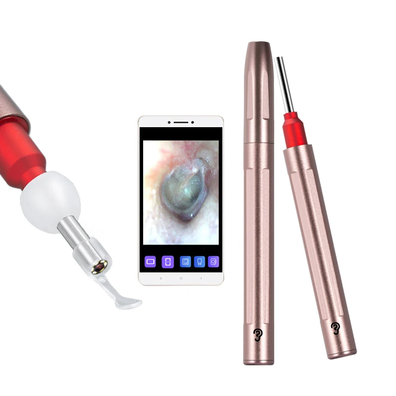 

Smart Visua Ear Wax HD Endoscope Electric Ear Cleaner with Camera, Black,pink
