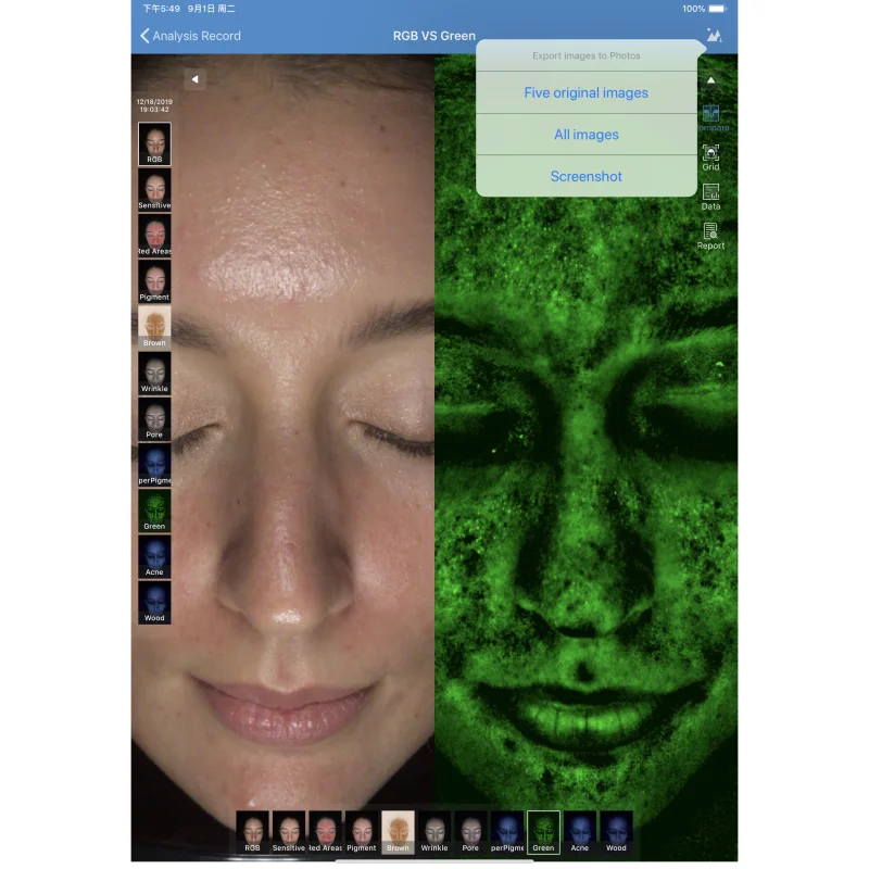 

Ipad Version Facial Skin Analyzer 8 Image 2021 Equipment