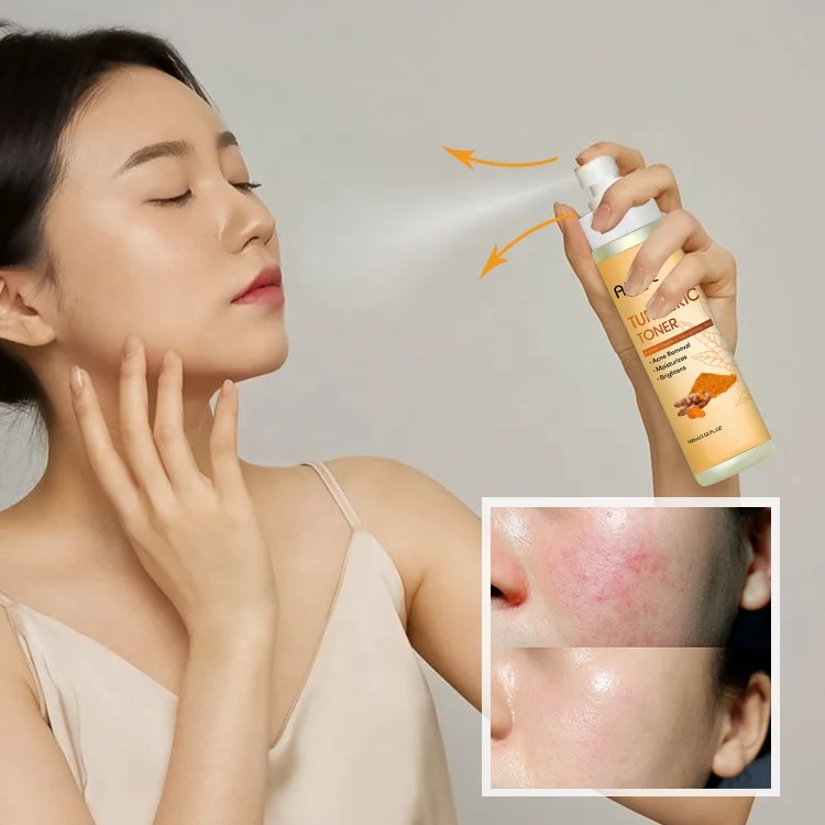

ailke Witch Hazel Face Toners Vitamin C Acne Facial Spray Turmeric Toner Skin Care Products