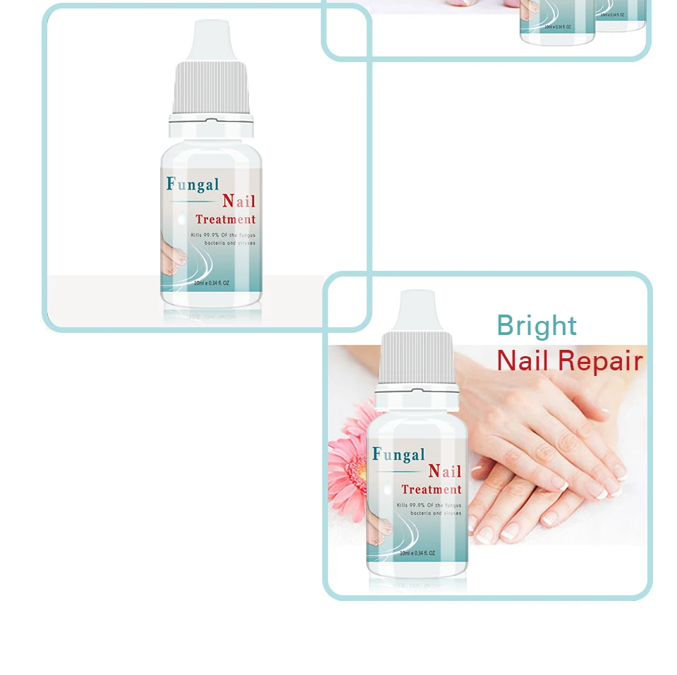 Lanthome Anti Fungus Infection Antibacterial Fungal Nail Treatment Feet Care Whitening