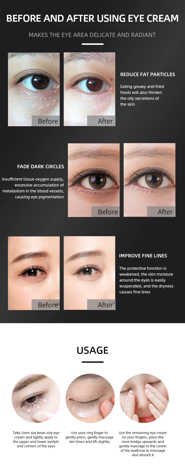 dark eyelids cream