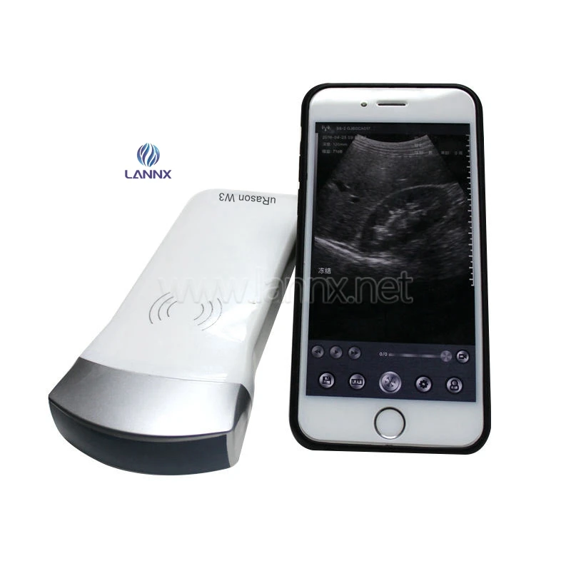 

LANNX uRason W3 Handheld wireless ultrasound probe Scanner Wifi Usb Color ultrasonic Convex Probes Professional Ultrasound Probe