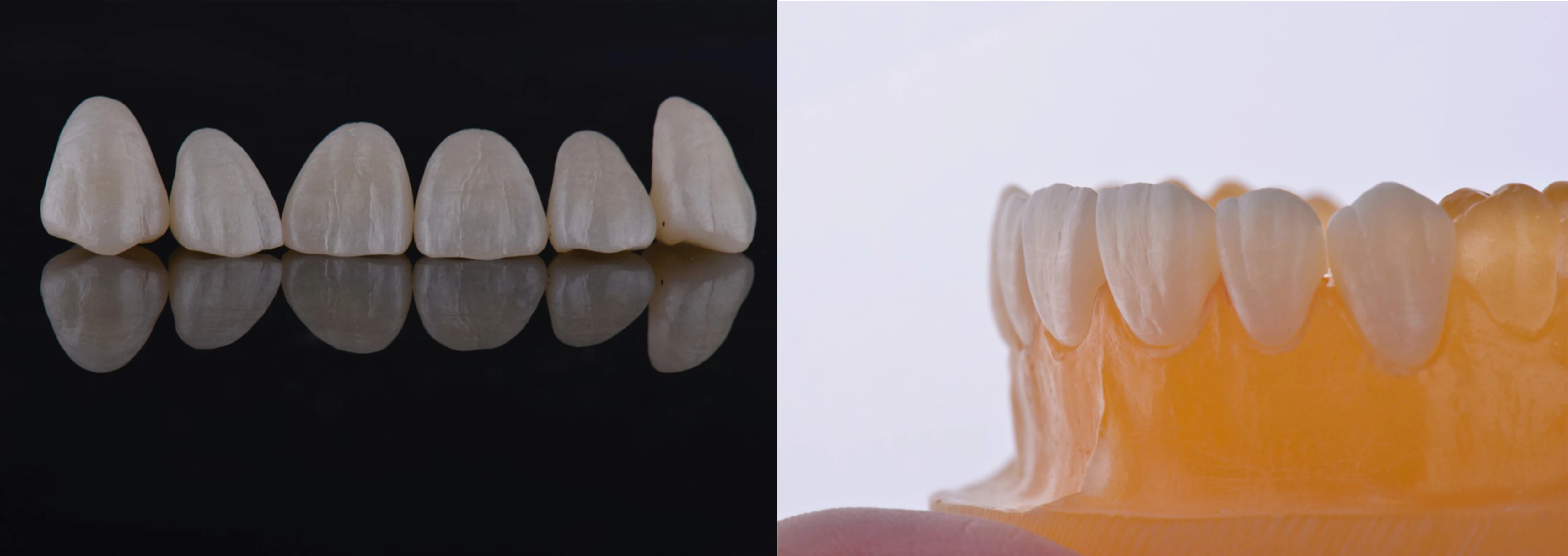Yucera UT White Multilayer Construction Durable Ceramic Blocks the Dentist's Choice for Strength and Aesthetics